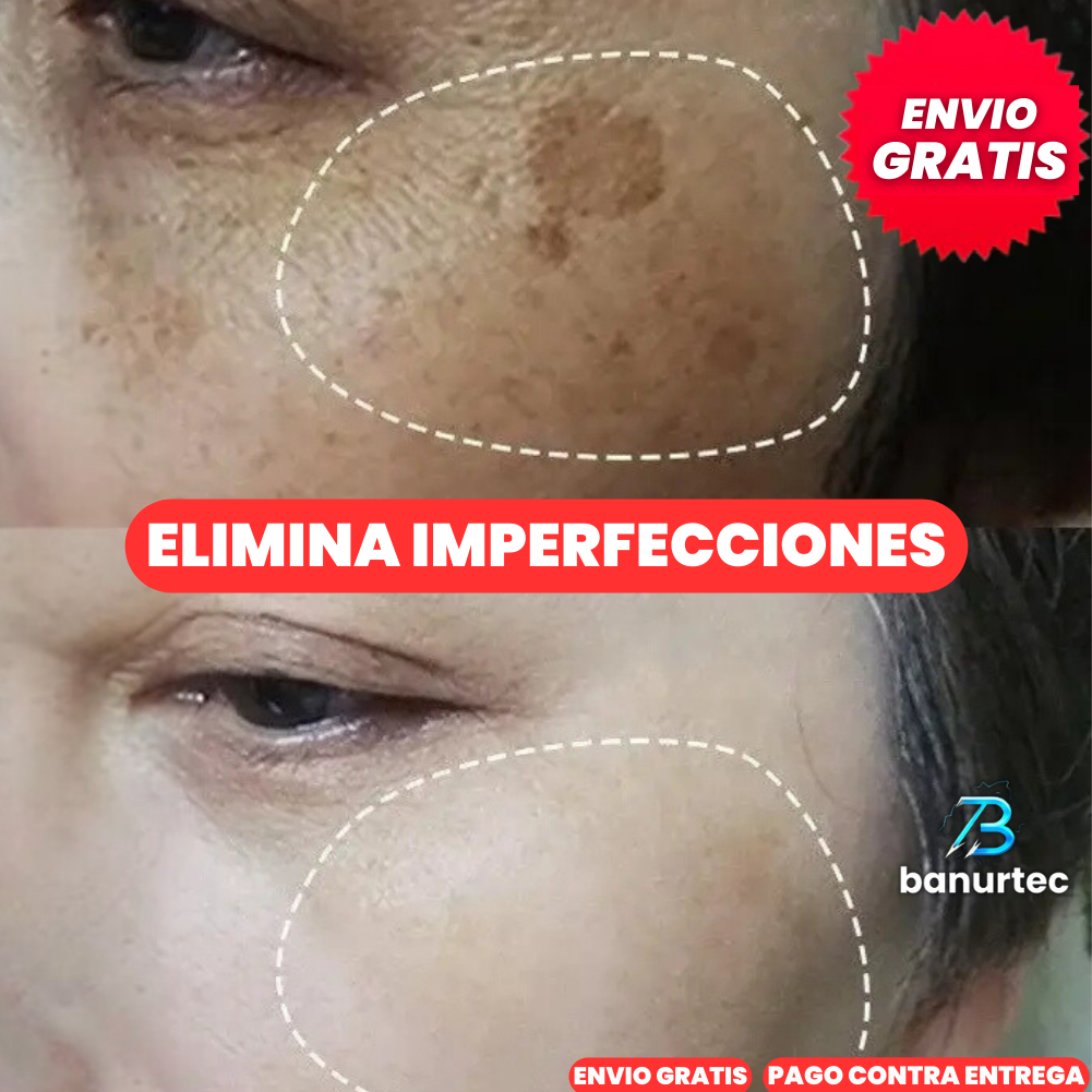 Niaglow S10 | Serum Anti Acné Ultra Concentrado con Ácido Salicílico