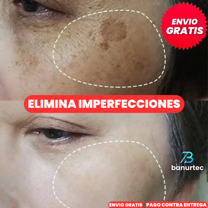 Niaglow S10 | Serum Anti Acné Ultra Concentrado con Ácido Salicílico